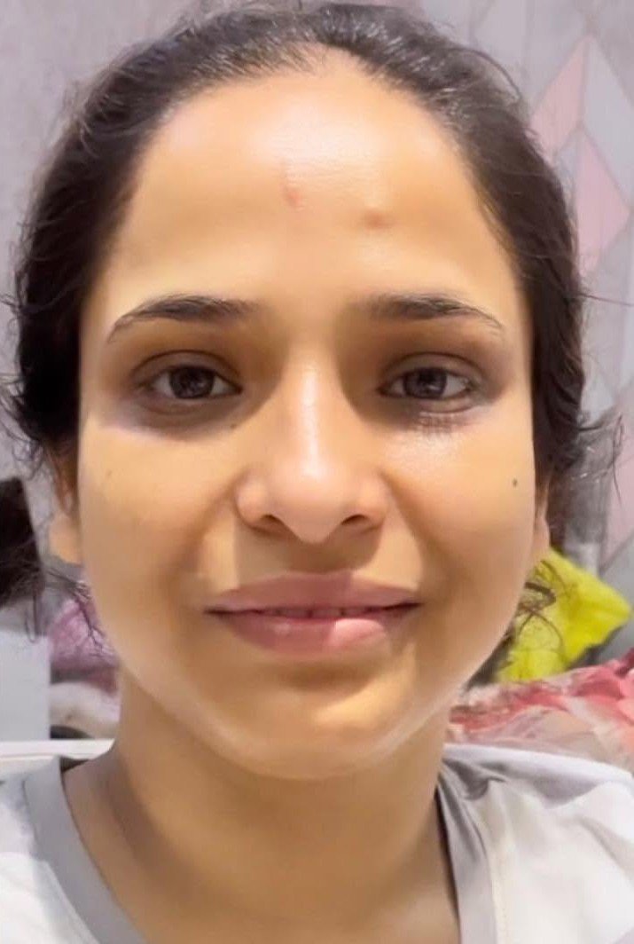 Before — Skin Care Treatment